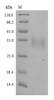 (Tris-Glycine gel) Discontinuous SDS-PAGE (reduced) with 5% enrichment gel and 15% separation gel.
