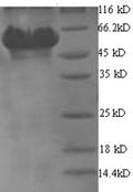 Recombinant Helicobacter pylori Glutamate--tRNA ligase 1 (gltX1) – Figure 1 of 1