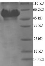 Recombinant Helicobacter pylori Glutamate--tRNA ligase 1 (gltX1) – Figure 1 of 1