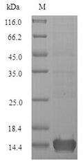 (Tris-Glycine gel) Discontinuous SDS-PAGE (reduced) with 5% enrichment gel and 15% separation gel.
