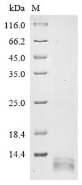 (Tris-Glycine gel) Discontinuous SDS-PAGE (reduced) with 5% enrichment gel and 15% separation gel.