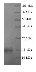 Recombinant Zaire ebolavirus Envelope glycoprotein (GP), partial – Figure 1 of 1