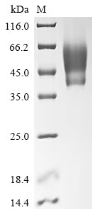 (Tris-Glycine gel) Discontinuous SDS-PAGE (reduced) with 5% enrichment gel and 15% separation gel.