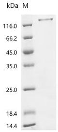 (Tris-Glycine gel) Discontinuous SDS-PAGE (reduced) with 5% enrichment gel and 15% separation gel.