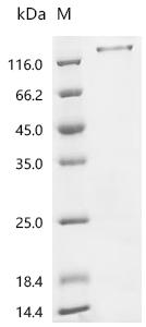 (Tris-Glycine gel) Discontinuous SDS-PAGE (reduced) with 5% enrichment gel and 15% separation gel.