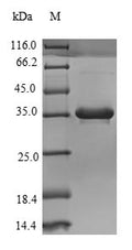 Recombinant Human Complement C4-B (C4B), partial – Figure 1 of 1