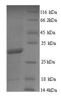 Recombinant Mycobacterium tuberculosis Diacylglycerol acyltransferase/mycolyltransferase Ag85B (fbpB) – Figure 1 of 1