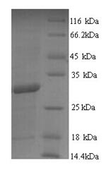 Recombinant Mycobacterium tuberculosis Diacylglycerol acyltransferase/mycolyltransferase Ag85B (fbpB) – Figure 1 of 1
