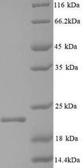Recombinant Hepatitis B virus genotype C subtype ayw Capsid protein (C) – Figure 1 of 1