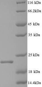 Recombinant Hepatitis B virus genotype C subtype ayw Capsid protein (C) – Figure 1 of 1