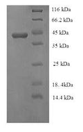 Recombinant Mycoplasma hyopneumoniae 46KDA surface antigen (p46) – Figure 1 of 1