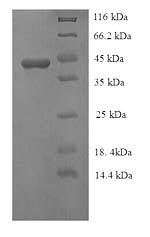 Recombinant Mycoplasma hyopneumoniae 46KDA surface antigen (p46) – Figure 1 of 1