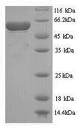 Recombinant Streptococcus pneumoniae serotype 4 Pneumolysin (ply) – Figure 1 of 1