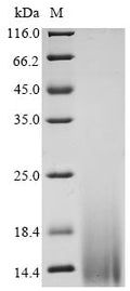 (Tris-Glycine gel) Discontinuous SDS-PAGE (reduced) with 5% enrichment gel and 15% separation gel.