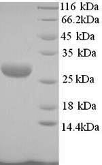 Recombinant Mannheimia haemolytica Leukotoxin (lktA), partial – Figure 1 of 1