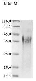 (Tris-Glycine gel) Discontinuous SDS-PAGE (reduced) with 5% enrichment gel and 15% separation gel.