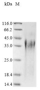 (Tris-Glycine gel) Discontinuous SDS-PAGE (reduced) with 5% enrichment gel and 15% separation gel.