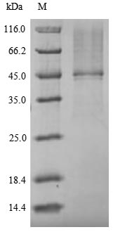 (Tris-Glycine gel) Discontinuous SDS-PAGE (reduced) with 5% enrichment gel and 15% separation gel.