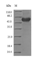 Recombinant Chicken Ovoinhibitor (OIH), partial – Figure 1 of 1