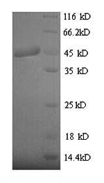 (Tris-Glycine gel) Discontinuous SDS-PAGE (reduced) with 5% enrichment gel and 15% separation gel.