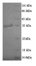 Recombinant Epstein-Barr virus Latent membrane protein 1 (LMP1), partial – Figure 1 of 1