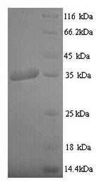 Recombinant Epstein-Barr virus Latent membrane protein 1 (LMP1), partial – Figure 1 of 1