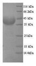 Recombinant Plasmodium falciparum Multidrug resistance protein (MDR1), partial – Figure 1 of 1