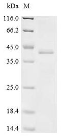 (Tris-Glycine gel) Discontinuous SDS-PAGE (reduced) with 5% enrichment gel and 15% separation gel.