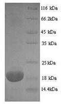 Recombinant Mouse Major urinary protein 2 (Mup2) – Figure 1 of 1