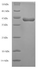 (Tris-Glycine gel) Discontinuous SDS-PAGE (reduced) with 5% enrichment gel and 15% separation gel.
