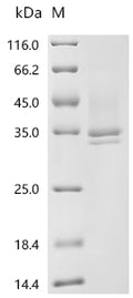 (Tris-Glycine gel) Discontinuous SDS-PAGE (reduced) with 5% enrichment gel and 15% separation gel.