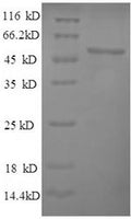 Recombinant Saccharomyces cerevisiae Pyruvate carboxylase 1 (PYC1), partial – Figure 1 of 1