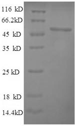 Recombinant Saccharomyces cerevisiae Pyruvate carboxylase 1 (PYC1), partial – Figure 1 of 1