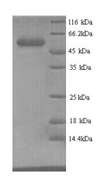 Recombinant Escherichia coli Aerobic glycerol-3-phosphate dehydrogenase (glpD) – Figure 1 of 1