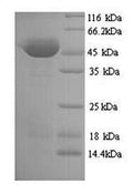 Recombinant Clostridium botulinum Botulinum neurotoxin type A (botA), partial – Figure 1 of 1