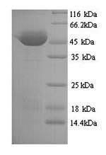 Recombinant Clostridium botulinum Botulinum neurotoxin type A (botA), partial – Figure 1 of 1