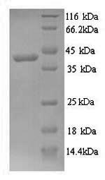 Recombinant Saccharomyces cerevisiae Glycerol 2-dehydrogenase (GCY1) – Figure 1 of 1