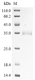 (Tris-Glycine gel) Discontinuous SDS-PAGE (reduced) with 5% enrichment gel and 15% separation gel.