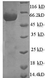 Recombinant Rabies virus Nucleoprotein (N) – Figure 1 of 1