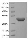 (Tris-Glycine gel) Discontinuous SDS-PAGE (reduced) with 5% enrichment gel and 15% separation gel.