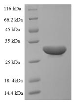 (Tris-Glycine gel) Discontinuous SDS-PAGE (reduced) with 5% enrichment gel and 15% separation gel.