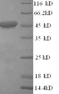 Recombinant Rotavirus A Intermediate capsid protein VP6 – Figure 1 of 1