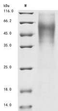 (Tris-Glycine gel) Discontinuous SDS-PAGE (reduced) with 5% enrichment gel and 15% separation gel.