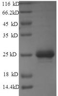 Recombinant Rabies virus Matrix protein (M) – Figure 1 of 1