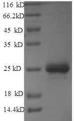 Recombinant Rabies virus Matrix protein (M) – Figure 1 of 1