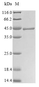 (Tris-Glycine gel) Discontinuous SDS-PAGE (reduced) with 5% enrichment gel and 15% separation gel.
