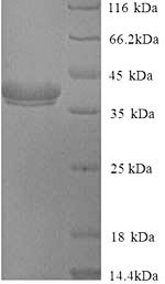 (Tris-Glycine gel) Discontinuous SDS-PAGE (reduced) with 5% enrichment gel and 15% separation gel.