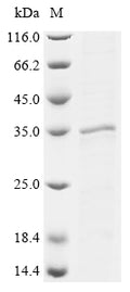(Tris-Glycine gel) Discontinuous SDS-PAGE (reduced) with 5% enrichment gel and 15% separation gel.