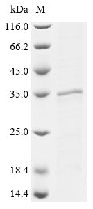(Tris-Glycine gel) Discontinuous SDS-PAGE (reduced) with 5% enrichment gel and 15% separation gel.