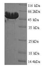Recombinant Clostridium botulinum D phage Botulinum neurotoxin type D (botD), partial – Figure 1 of 1
